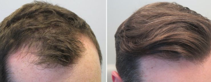 Before & After